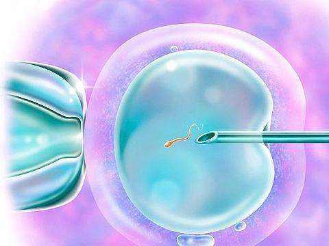 做泰国试管婴儿对精子的要求高不高？